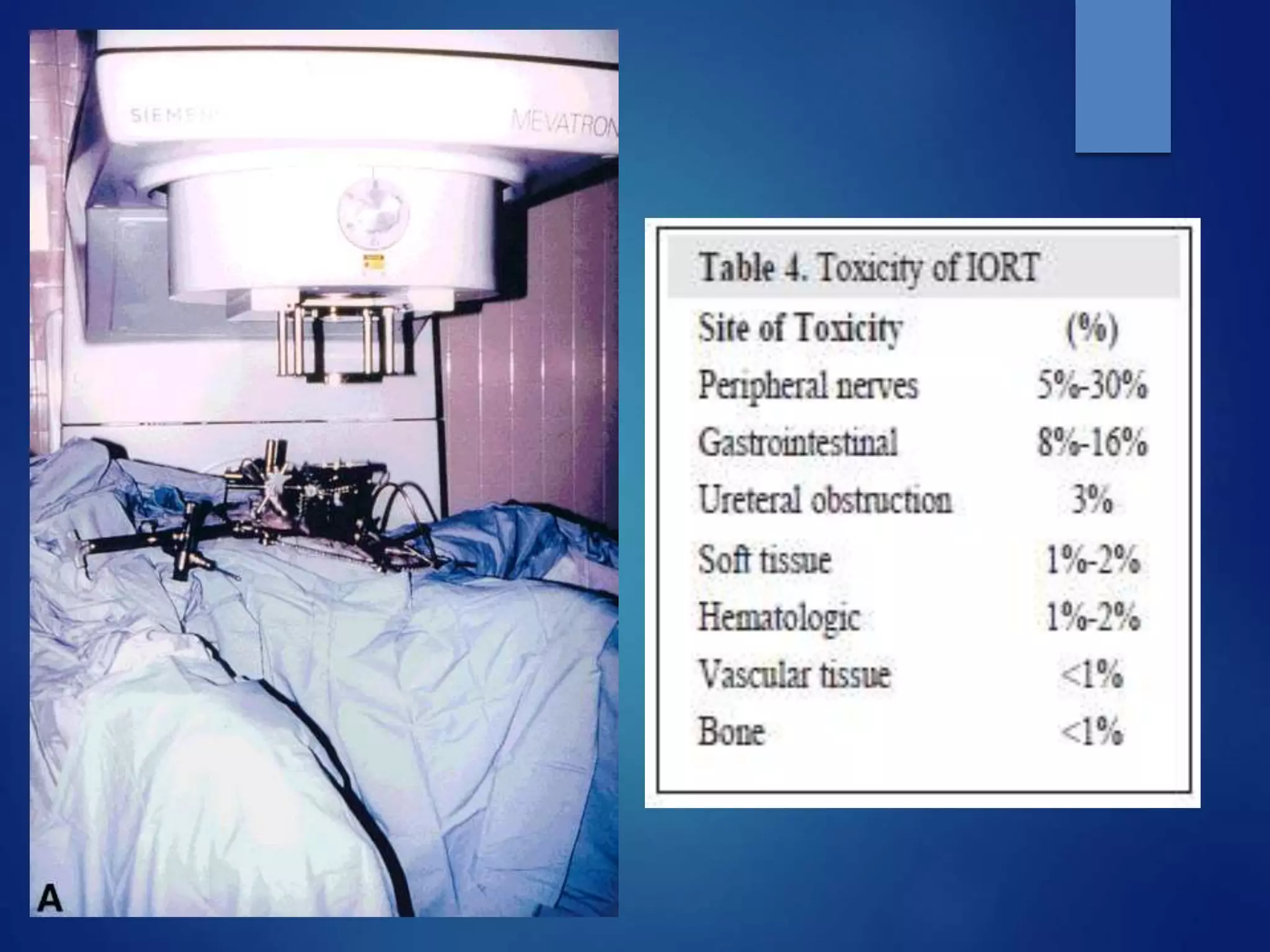 Cd R Radiotherapy Role of radiotherapy in recurrent carcinoma cervix | PPTX