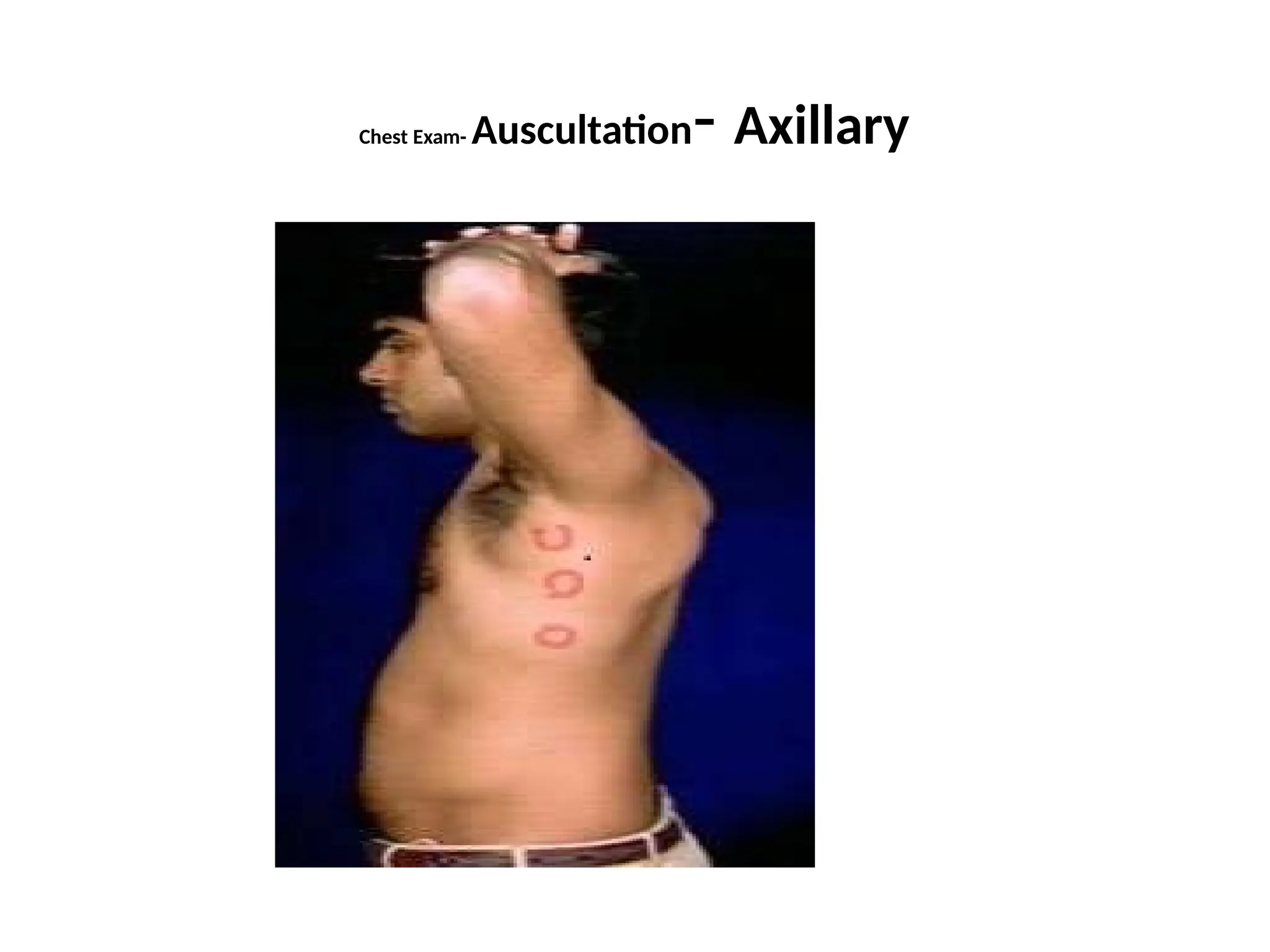Chest Exam- Auscultation- Axillary
 
