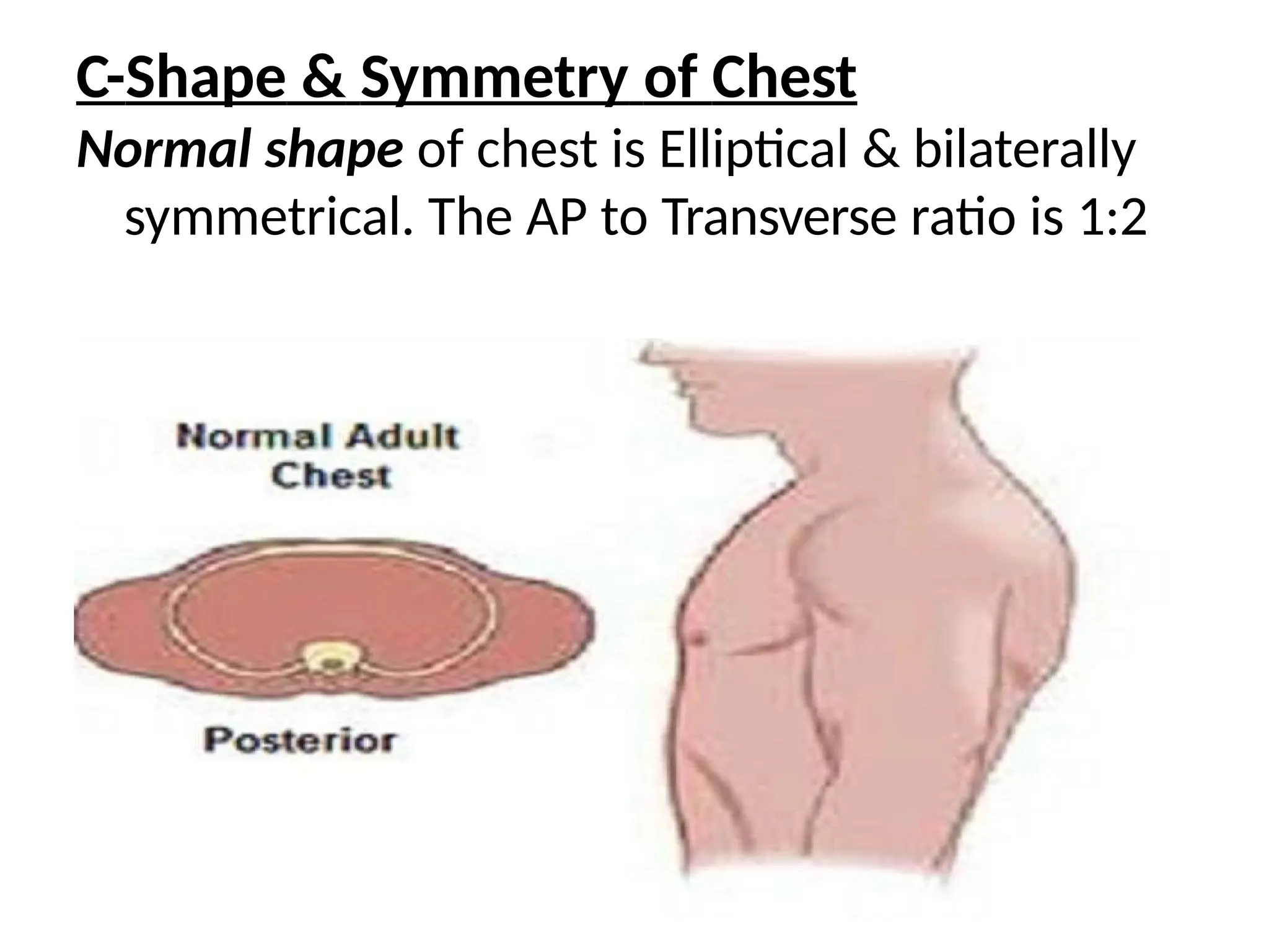 C-Shape & Symmetry of Chest
Normal shape of chest is Elliptical & bilaterally
symmetrical. The AP to Transverse ratio is 1:2
 