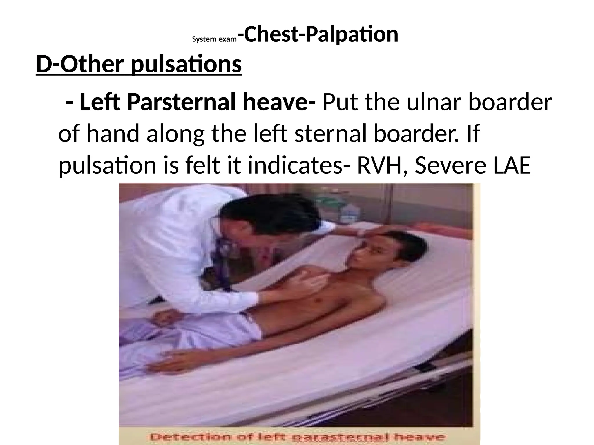 System exam-Chest-Palpation
D-Other pulsations
- Left Parsternal heave- Put the ulnar boarder
of hand along the left sternal boarder. If
pulsation is felt it indicates- RVH, Severe LAE
 