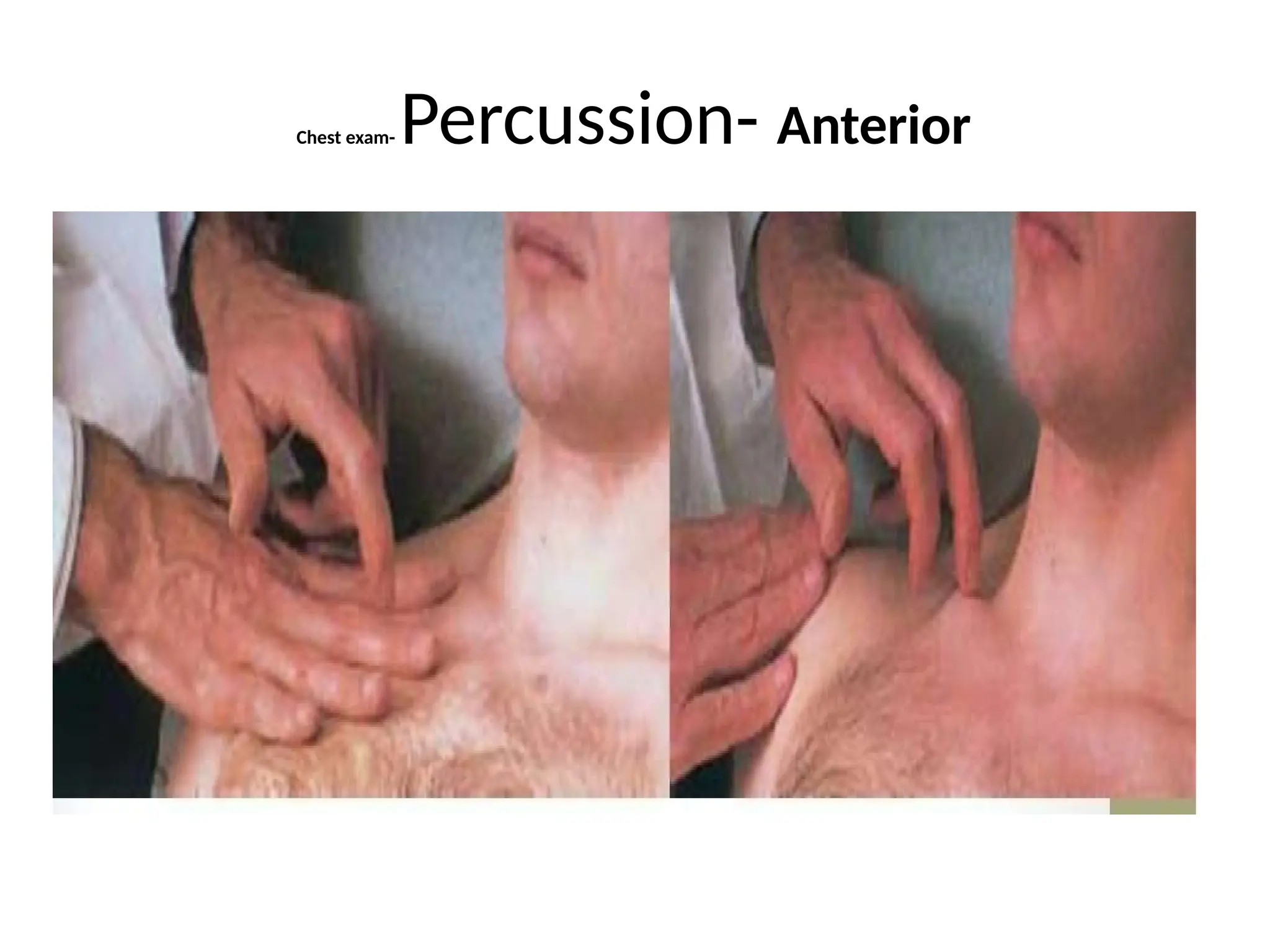 Chest exam- Percussion- Anterior
 