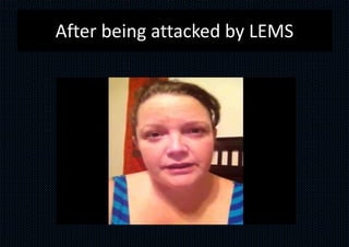 After being attacked by LEMS
 