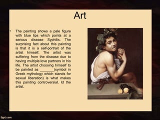 Art
• The painting shows a pale figure
with blue lips which points at a
serious disease Syphilis. The
surprising fact about this painting
is that it is a self-portrait of the
artist himself. The artist was
suffering from the disease due to
having multiple love partners in his
life. The artist choosing himself to
be painted as _______(symbol in
Greek mythology which stands for
sexual liberation) is what makes
this painting controversial. Id the
artist.
 