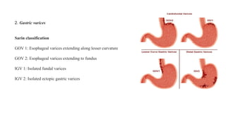 Jsph Varices Classification Preparation on portal hypertension and varices | PPTX
