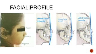 Mandibular tori
Fibromatosis gingiva
 