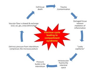 management of open fracture | PPT