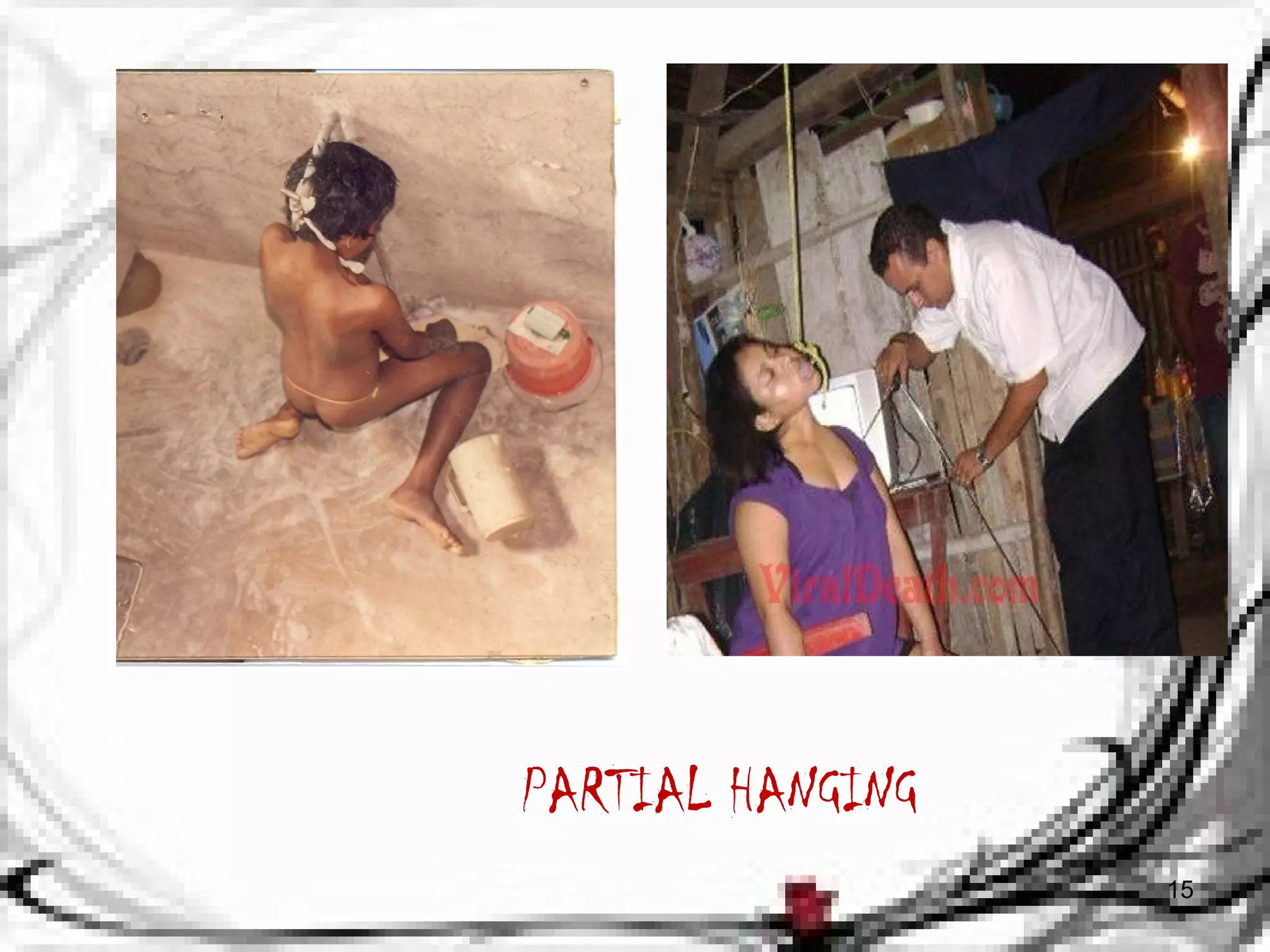 PARTIAL HANGING 
15 
 