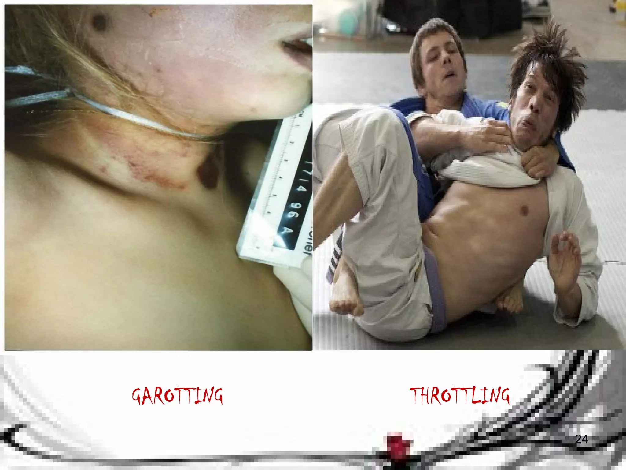 24 
GAROTTING THROTTLING 
 