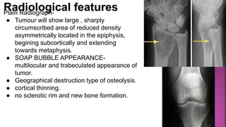 Plain Radiograph-
● Tumour will show large , sharply
circumscribed area of reduced density
asymmetrically located in the epiphysis,
begining subcortically and extending
towards metaphysis.
● SOAP BUBBLE APPEARANCE-
multilocular and trabeculated appearance of
tumor.
● Geographical destruction type of osteolysis.
● cortical thinning.
● no sclerotic rim and new bone formation.
 