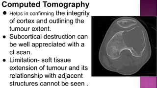 ● Helps in confirming the integrity
of cortex and outlining the
tumour extent.
● Subcortical destruction can
be well appreciated with a
ct scan.
● Limitation- soft tissue
extension of tumour and its
relationship with adjacent
structures cannot be seen .
 