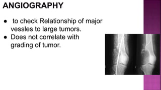 ● to check Relationship of major
vessles to large tumors.
● Does not correlate with
grading of tumor.
 
