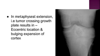 ● In metaphyseal extension,
i.e tumor crossing growth
plate results in –
Eccentric location &
bulging expansion of
cortex
 