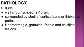 GROSS
● well circumscribed, 2-10 cm.
● surrounded by shell of cortical bone or thickened
periosteum.
● Haemorrhagic, granular , friable and calcified
lesions.
 
