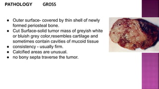 PATHOLOGY GROSS
● Outer surface- covered by thin shell of newly
formed periosteal bone.
● Cut Surface-solid tumor mass of greyish white
or bluish grey color,resembles cartilage and
sometimes contain cavities of mucoid tissue
● consistency - usually firm.
● Calcified areas are unusual.
● no bony septa traverse the tumor.
 