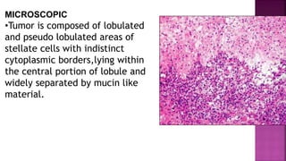 MICROSCOPIC
•Tumor is composed of lobulated
and pseudo lobulated areas of
stellate cells with indistinct
cytoplasmic borders,lying within
the central portion of lobule and
widely separated by mucin like
material.
 