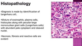•Diagnosis is made by identification of
langerhans cell.
•Mixture of eosinophils, plasma cells,
histiocytes along with peculiar large
mononuclear giant cells (Langerhans cells)
with abundant pale cytoplasm and cleaved
nuclei.
•Necrosis, fibrosis and reactive cells are
evident
 