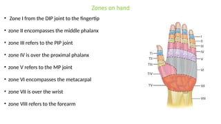 Comprehensive Overview of Common Flexor and Extensor Tendon Injuries of ...