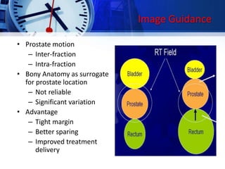 Image Guidance
• Prostate motion
– Inter-fraction
– Intra-fraction
• Bony Anatomy as surrogate
for prostate location
– Not reliable
– Significant variation
• Advantage
– Tight margin
– Better sparing
– Improved treatment
delivery
 