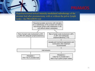 PRIAMOS
Hypofractionated helical intensity-modulated radiotherapy of the
prostate bed after prostatectomy with or without the pelvic lymph
nodes - the PRIAMOS trial
71
 
