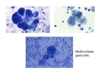Multinucleated Tissue Common Laboratory investigations in dermatology | PPT
