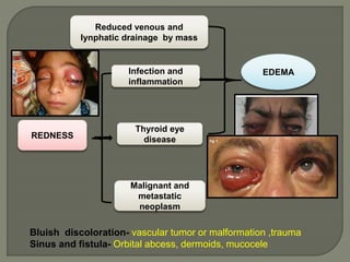 REDNESS
Infection and
inflammation
Thyroid eye
disease
Malignant and
metastatic
neoplasm
EDEMA
Reduced venous and
lynphatic drainage by mass
Bluish discoloration- vascular tumor or malformation ,trauma
Sinus and fistula- Orbital abcess, dermoids, mucocele
 