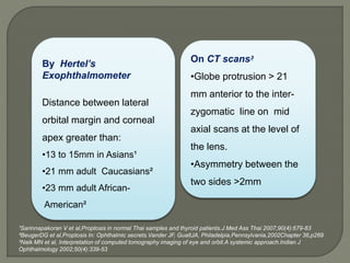 By Hertel’s
Exophthalmometer
Distance between lateral
orbital margin and corneal
apex greater than:
•13 to 15mm in Asians¹
•21 mm adult Caucasians²
•23 mm adult African-
American²
On CT scans³
•Globe protrusion > 21
mm anterior to the inter-
zygomatic line on mid
axial scans at the level of
the lens.
•Asymmetry between the
two sides >2mm
¹Sarinnapakoran V et al,Proptosis in normal Thai samples and thyroid patients.J Med Ass Thai 2007;90(4):679-83
²BeugerDG et al,Proptosis In: Ophthalmic secrets.Vander JF, GualtJA, Philadelpia,Pennsylvania,2002Chapter 36,p269
³Naik MN et al, Interpretation of computed tomography imaging of eye and orbit.A systemic approach.Indian J
Ophthalmology 2002;50(4):339-53
 