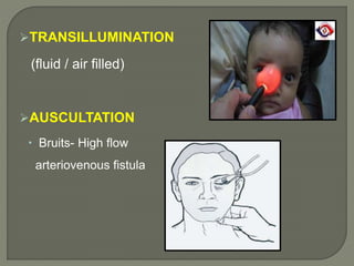 TRANSILLUMINATION
(fluid / air filled)
AUSCULTATION
 Bruits- High flow
arteriovenous fistula
 