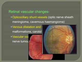 Retinal vascular changes-
Opticociliary shunt vessels (optic nerve sheath
meningioma, cavernous haemangioma)
Venous dilatation and tortousity (a-v
malformations, carotid cavernous fistula)
Vascular occlusions (orbital cellulitis and optic
nerve tumours
 