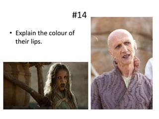 #14
• Explain the colour of
their lips.
 