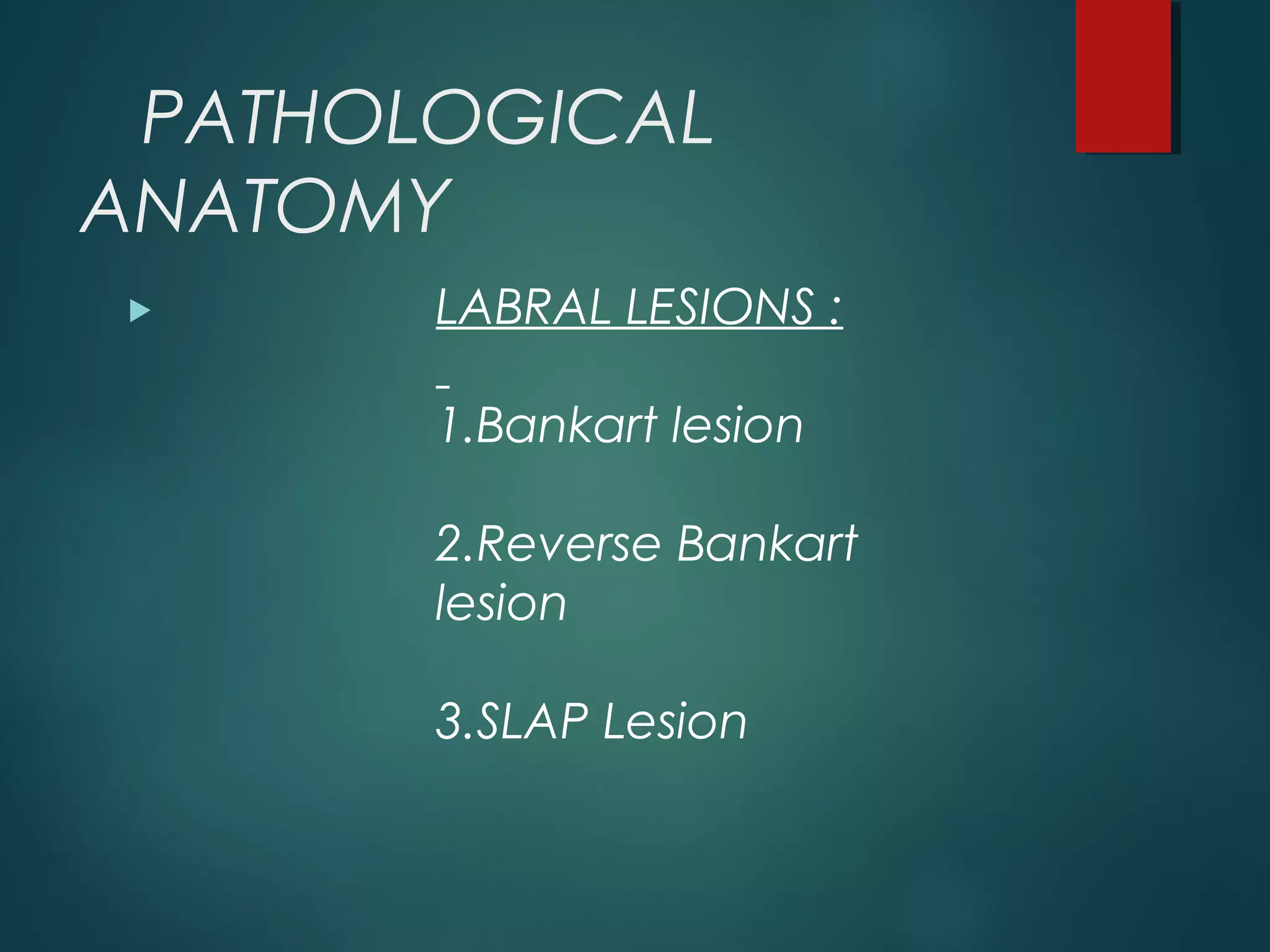 PATHOLOGICAL 
ANATOMY 
LABRAL LESIONS : 
1.Bankart lesion 
2.Reverse Bankart 
lesion 
3.SLAP Lesion 
 
 