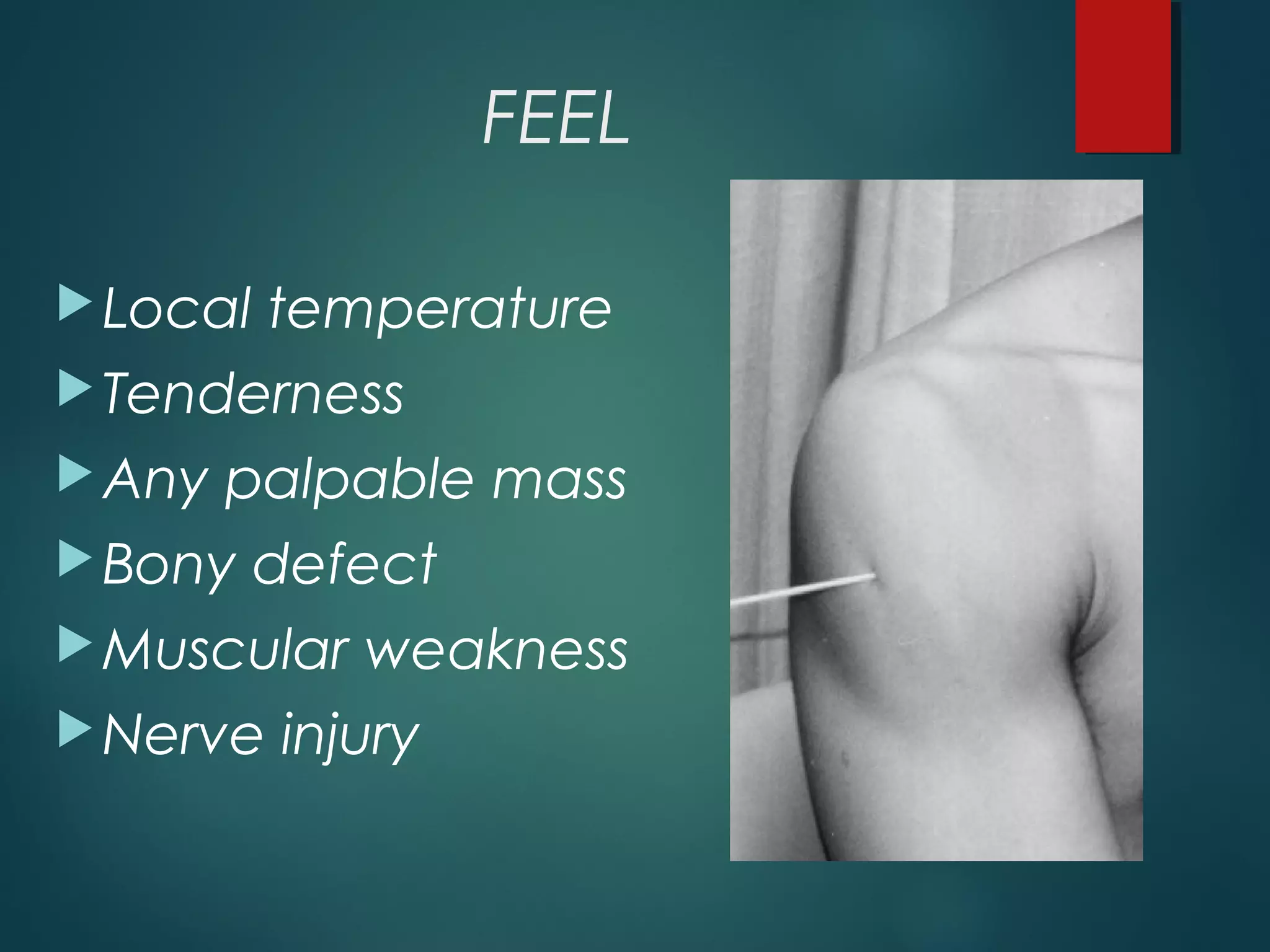 FEEL 
Local temperature 
Tenderness 
Any palpable mass 
Bony defect 
Muscular weakness 
Nerve injury 
 