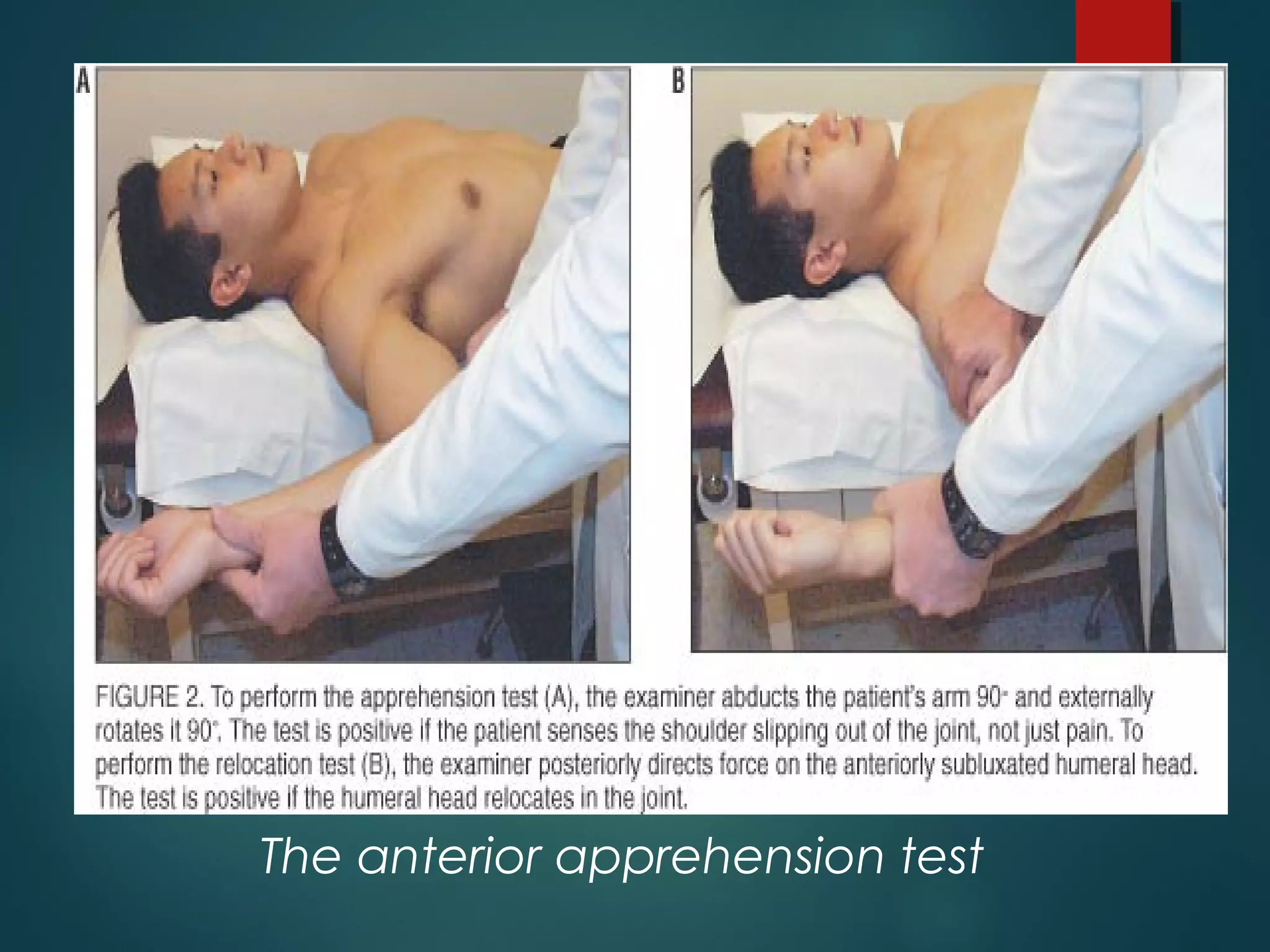 The anterior apprehension test 
 