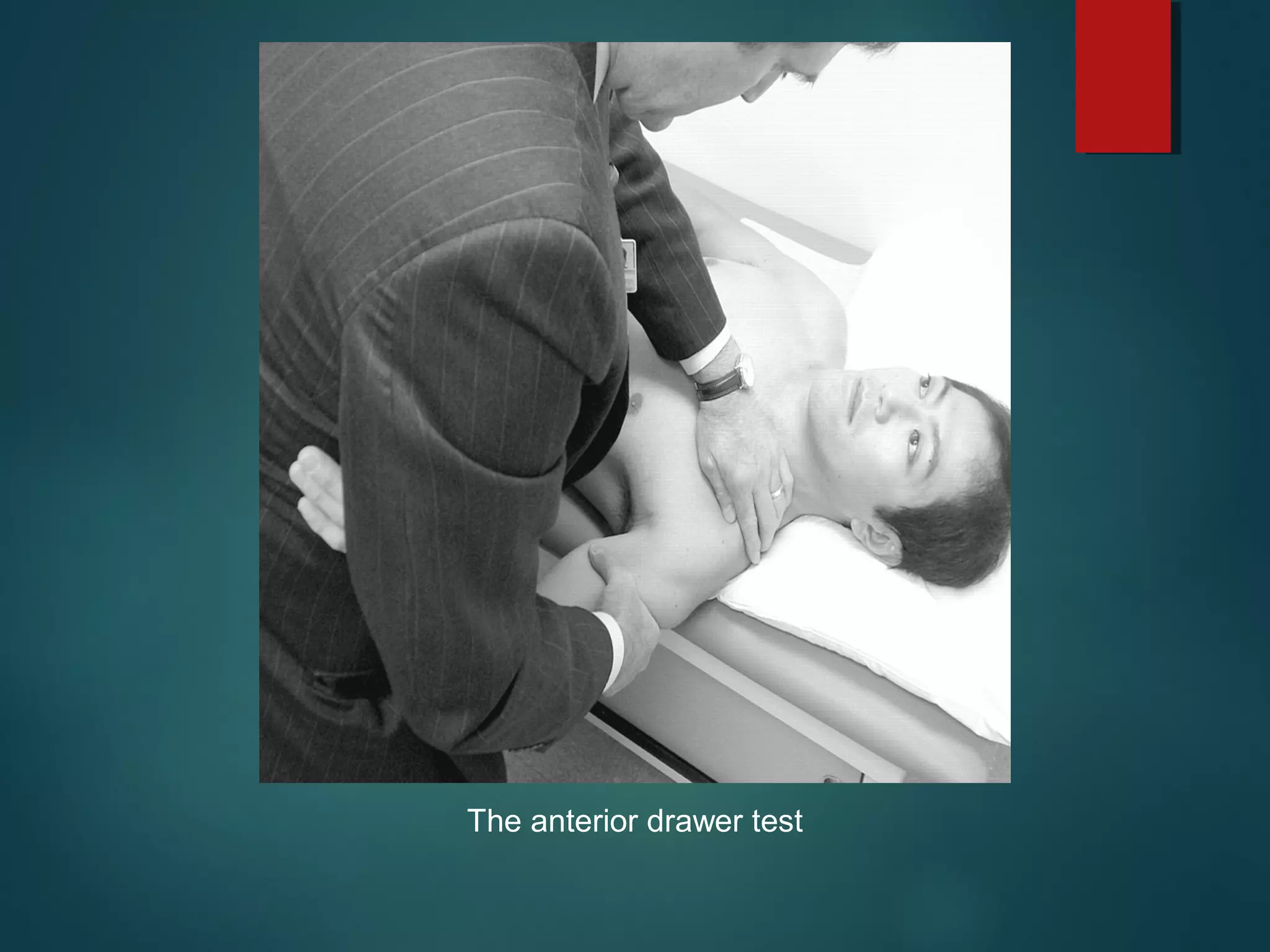 The anterior drawer test 
 