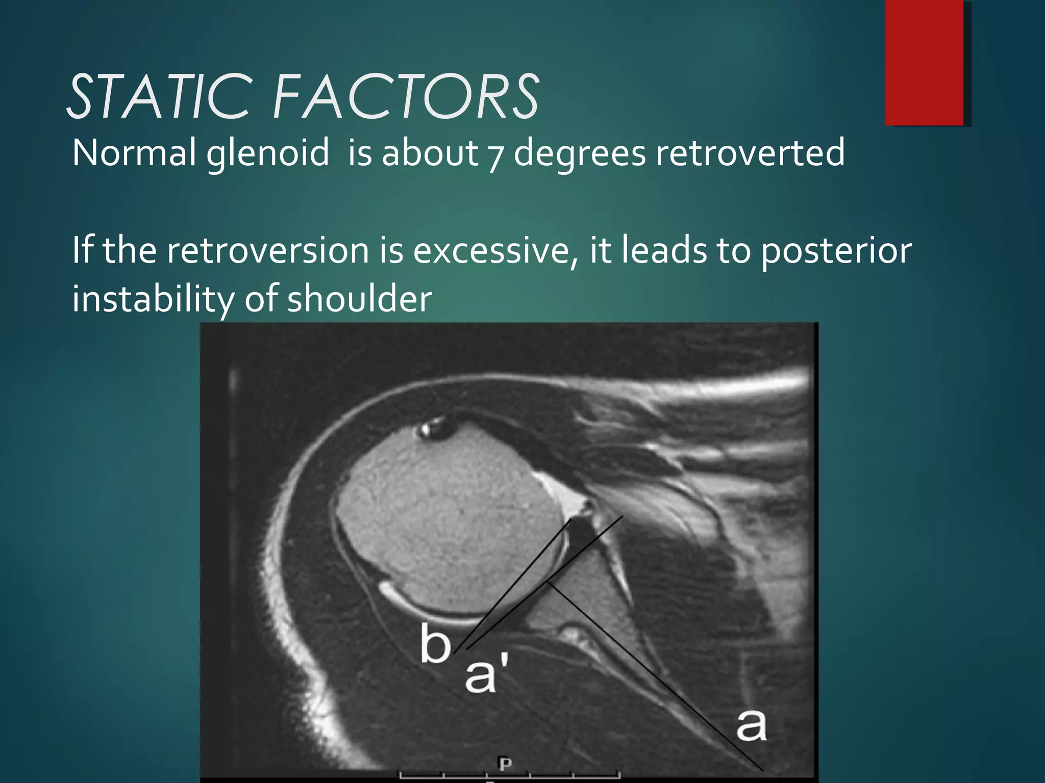 STATIC FACTORS 
Normal glenoid is about 7 degrees retroverted 
If the retroversion is excessive, it leads to posterior 
instability of shoulder 
 