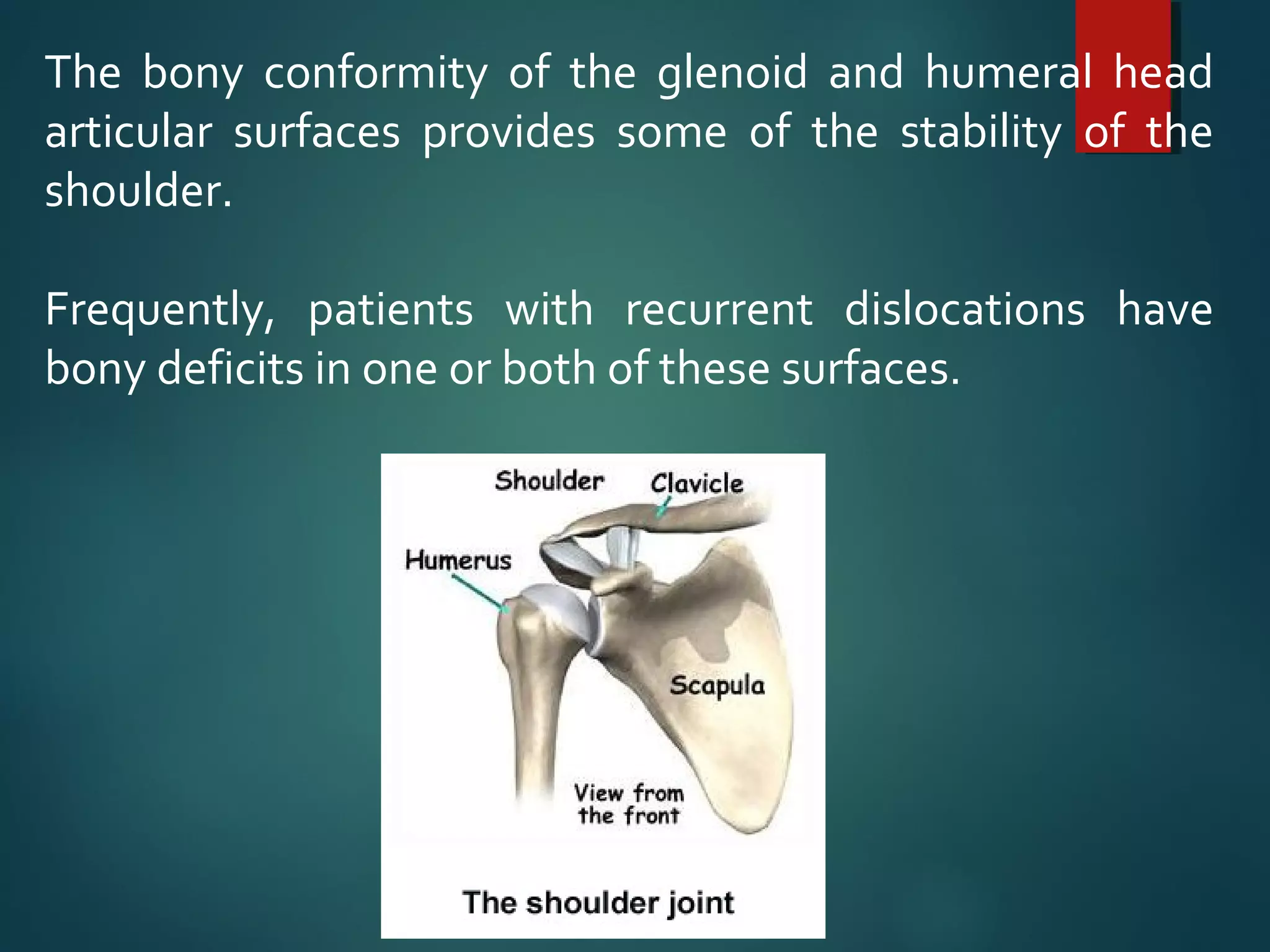The bony conformity of the glenoid and humeral head 
articular surfaces provides some of the stability of the 
shoulder. 
Frequently, patients with recurrent dislocations have 
bony deficits in one or both of these surfaces. 
 