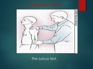 CLINICAL TESTS 
The sulcus test. 
 