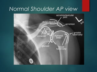 Normal Shoulder AP view 
 
