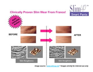 BEFORE AFTER
Smart PantsSmart PantsSmart PantsSmart Pants
Clinically Proven Slim Wear From France!
AFTER
Image source : www.skinup.net * Images strictly for internal use only
 