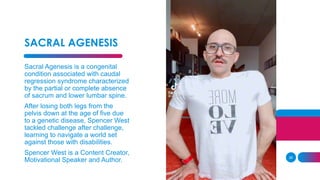 28
SACRAL AGENESIS
Sacral Agenesis is a congenital
condition associated with caudal
regression syndrome characterized
by the partial or complete absence
of sacrum and lower lumbar spine.
After losing both legs from the
pelvis down at the age of five due
to a genetic disease, Spencer West
tackled challenge after challenge,
learning to navigate a world set
against those with disabilities.
Spencer West is a Content Creator,
Motivational Speaker and Author.
 