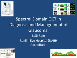 Spectral Domain OCT in
Diagnosis and Management of
          Glaucoma
             NSD Raju
    Ranjini Eye Hospital (NABH
            Accredited)
 