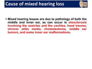 Cause of mixed hearing loss
 Mixed hearing losses are due to pathology of both the
middle and inner ear, as can occur in otosclerosis
involving the ossicles and the cochlea, head trauma,
chronic otitis media, cholesteatoma, middle ear
tumors, and some inner ear malformations.
 