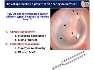 Clinical approach to a patient with hearing impairment
How we can differentiate between
different types & causes of hearing
loss ?!
1. Clinical assessment
a. otoscopic examination
b. tuning fork test
2. Laboratory assessment
a. Pure Tone Audiometry
b. CT scan & MRI
 