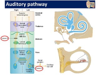 Auditory pathway
 
