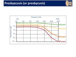 Presbyacusis (or presbycusis)
 