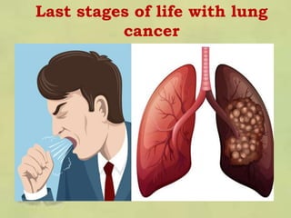Last stages of life with lung
cancer
 