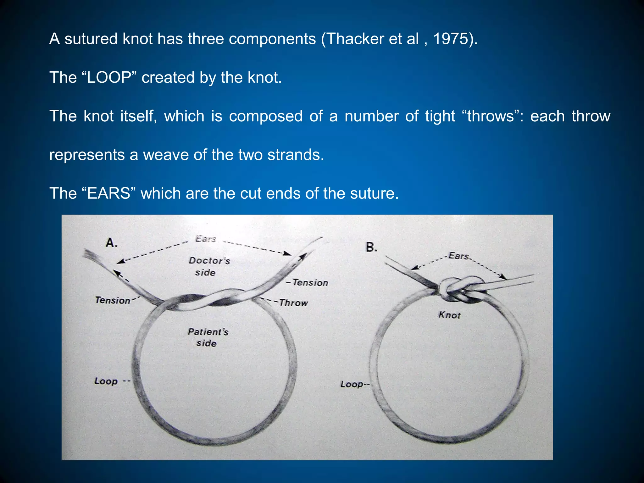 A sutured knot has three components (Thacker et al , 1975).
The “LOOP” created by the knot.
The knot itself, which is composed of a number of tight “throws”: each throw
represents a weave of the two strands.
The “EARS” which are the cut ends of the suture.
 