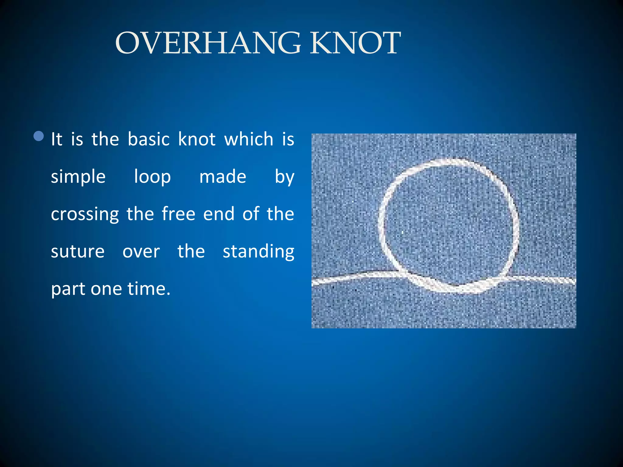 OVERHANG KNOT
It is the basic knot which is
simple loop made by
crossing the free end of the
suture over the standing
part one time.
 