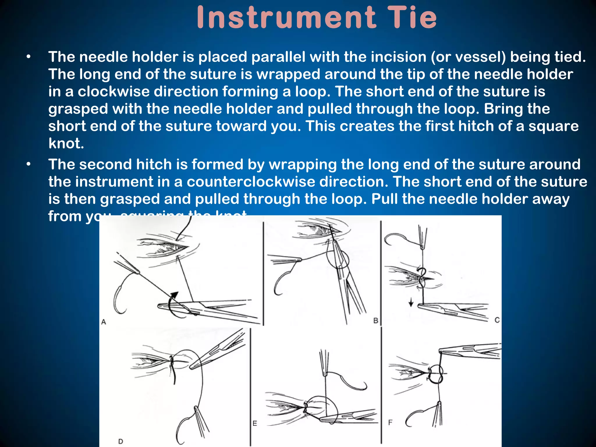 • The needle holder is placed parallel with the incision (or vessel) being tied.
The long end of the suture is wrapped around the tip of the needle holder
in a clockwise direction forming a loop. The short end of the suture is
grasped with the needle holder and pulled through the loop. Bring the
short end of the suture toward you. This creates the first hitch of a square
knot.
• The second hitch is formed by wrapping the long end of the suture around
the instrument in a counterclockwise direction. The short end of the suture
is then grasped and pulled through the loop. Pull the needle holder away
from you, squaring the knot.
Instrument Tie
 