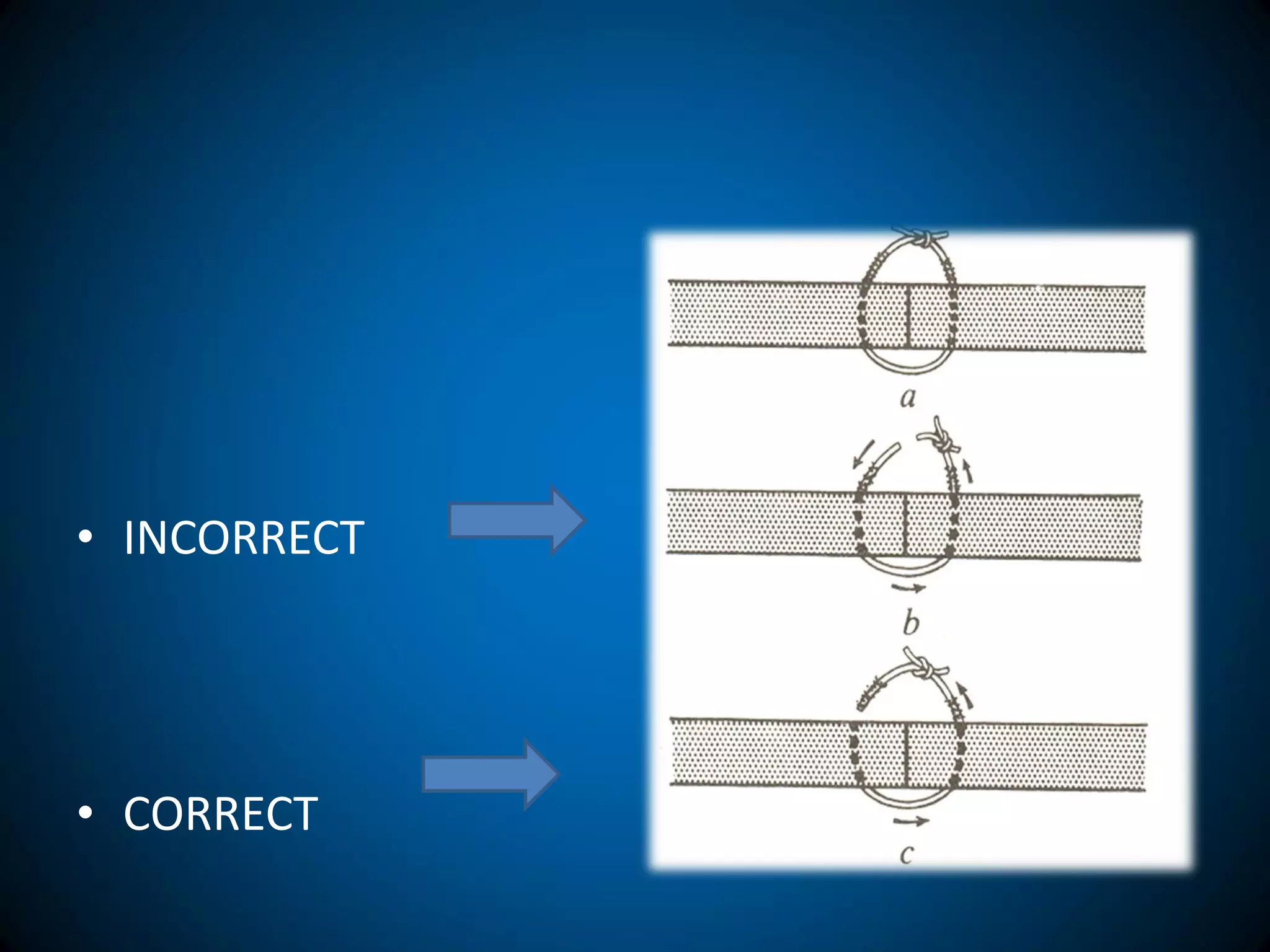 • INCORRECT
• CORRECT
 