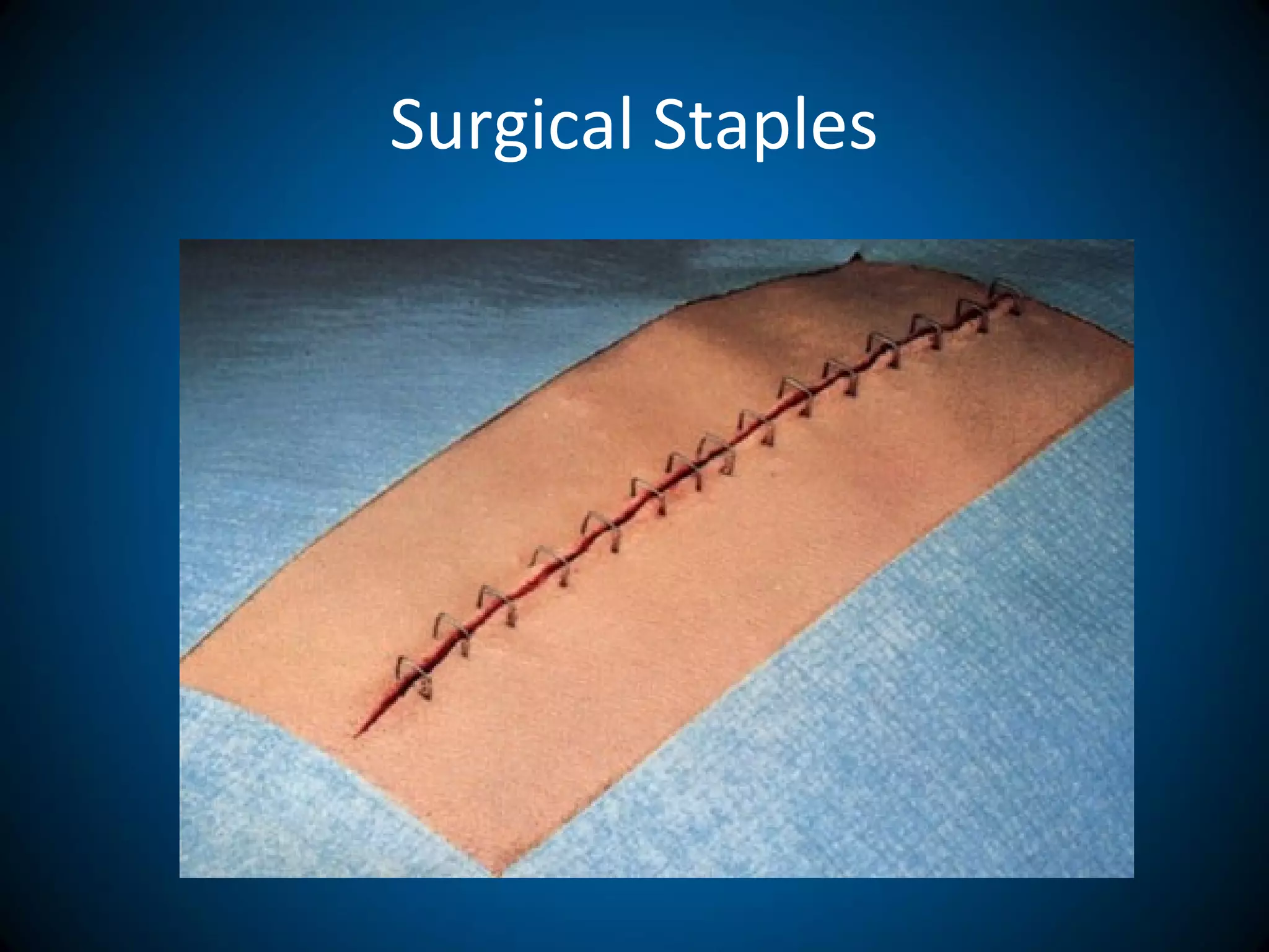 Surgical Staples
 